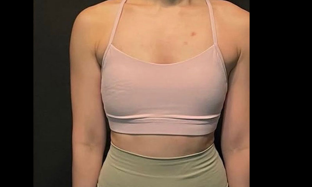 After Transformation 7