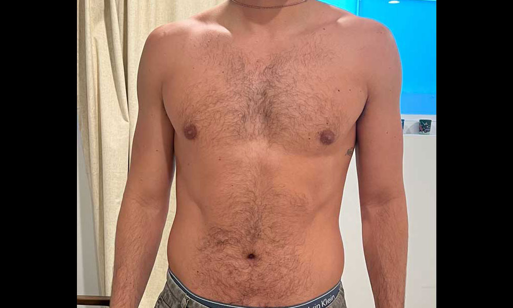 Before Transformation 1