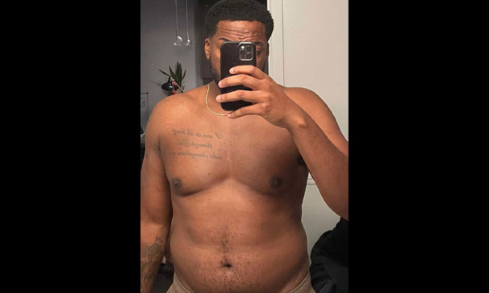 Before Transformation 2