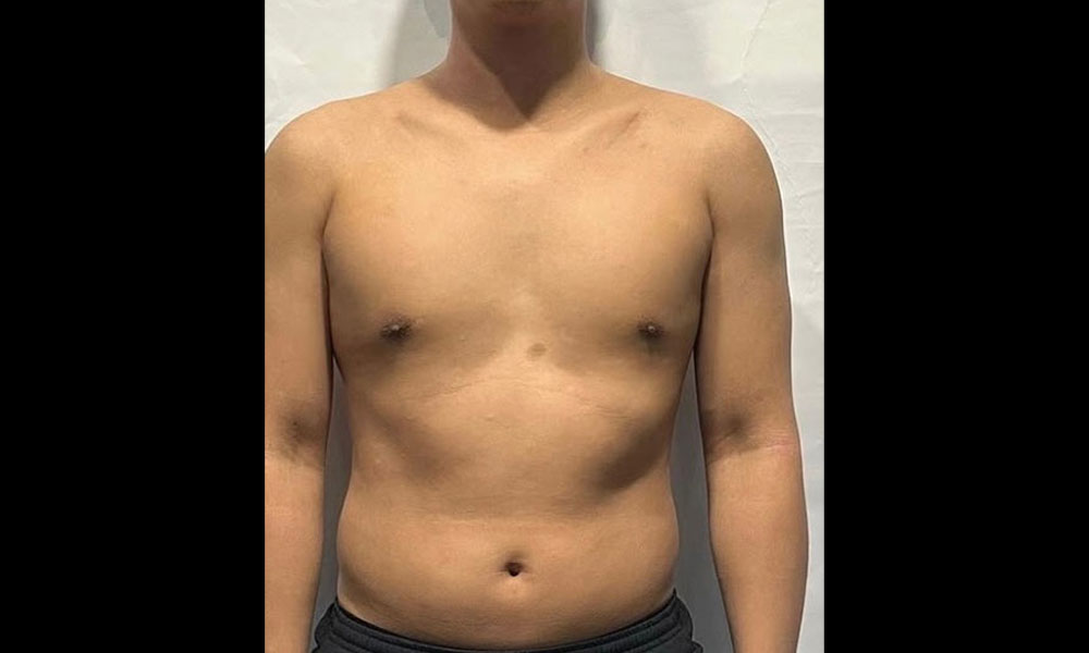 Before Transformation 3