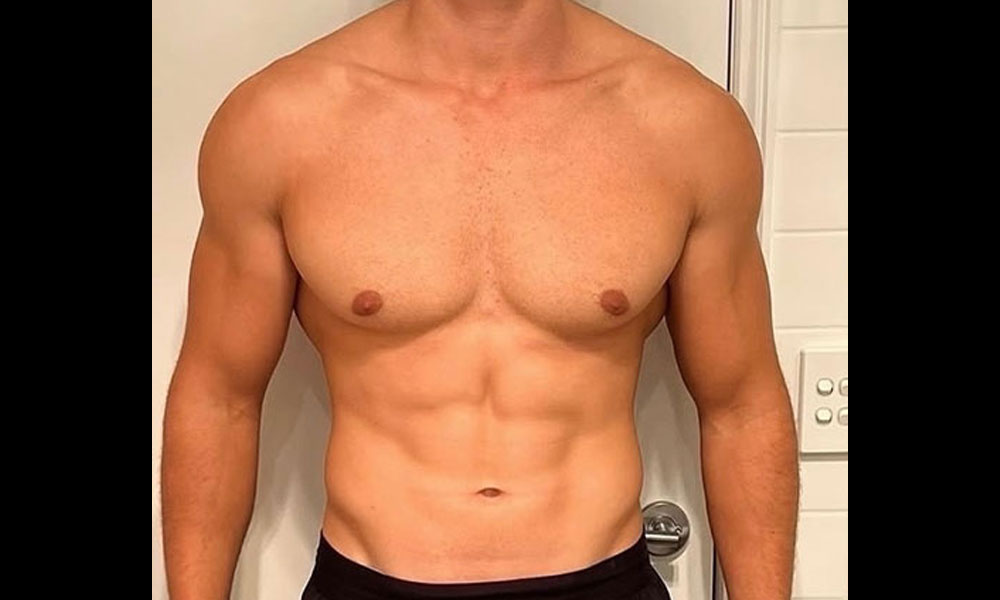 Before Transformation 4